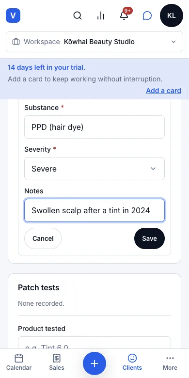 Allergy and medical notes — PPD, severe — Phone