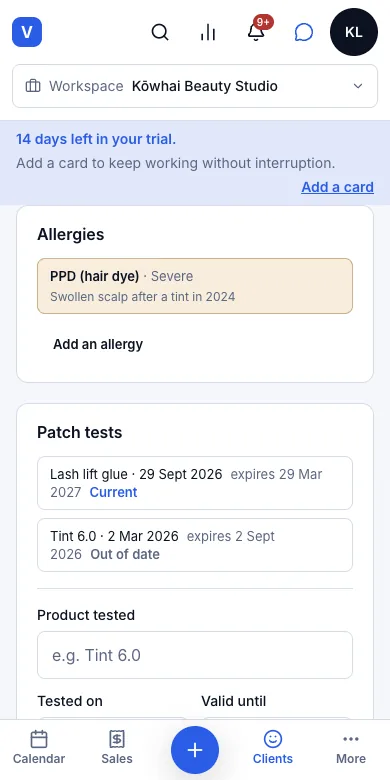 Allergy and medical notes — Result — the allergy on the Records tab — Phone